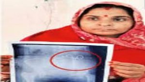 महिला के पेट में मिली कैंची, ऑपरेशन के दौरान डाॅक्टरों ने की लापरवाही