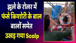 झूले के रोलर में फंसे किशोरी के बाल, बालों समेत उखड़ गया Scalp
