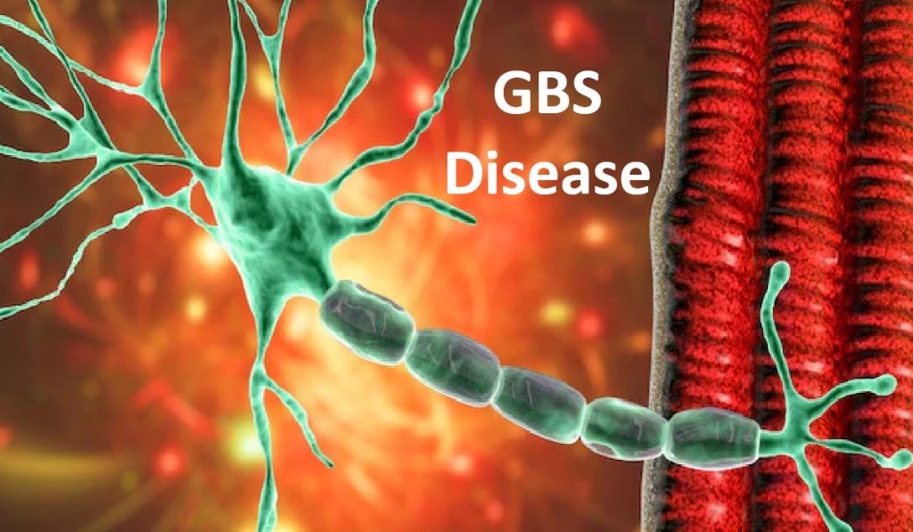 GBS Disease