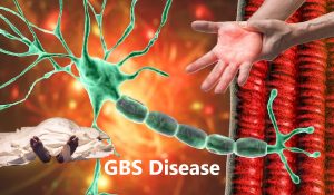 Pune में GBS से दहशत, 28 में से अब तक 11 ने तोड़ा दम
