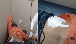 हैरानीजनक : युवक ने You Tube वीडियो देख कर डाली खुद की सर्जरी, लम्बे समय से पेटदर्द से था परेशान