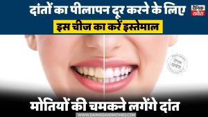 दांतों का पीलापन दूर करने के लिए इस चीज का करें इस्तेमाल, मोतियों की तरह चमकने लगेंगे दांत