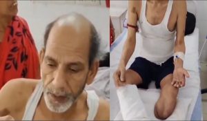 NMCH अस्पताल में हुई चौंकाने वाली घटना, चूहें ने कुतरे मरीज के पैर… तेजस्वी यादव ने शेयर किया Video