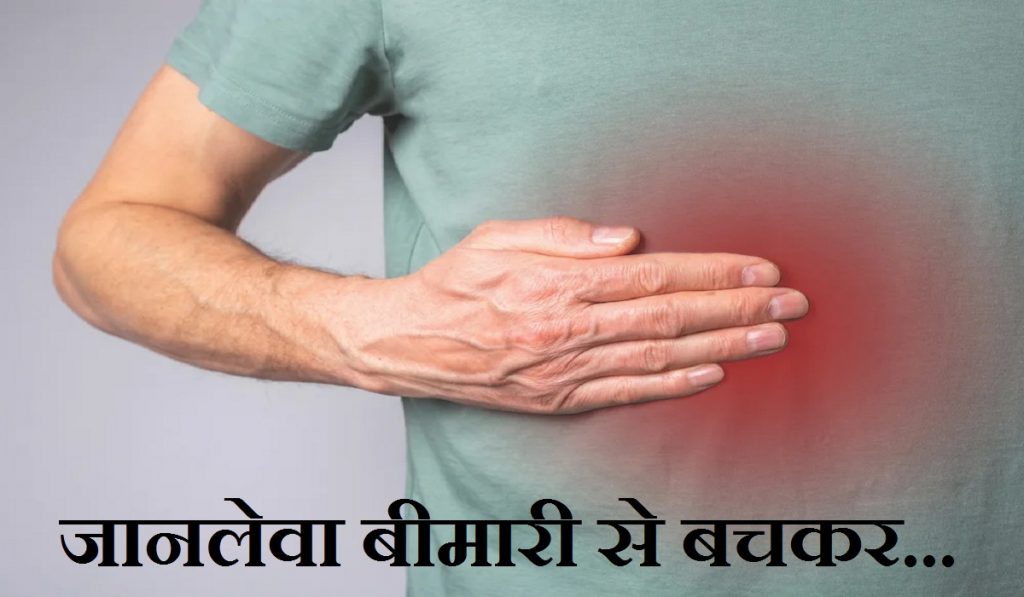 stomach cancer
