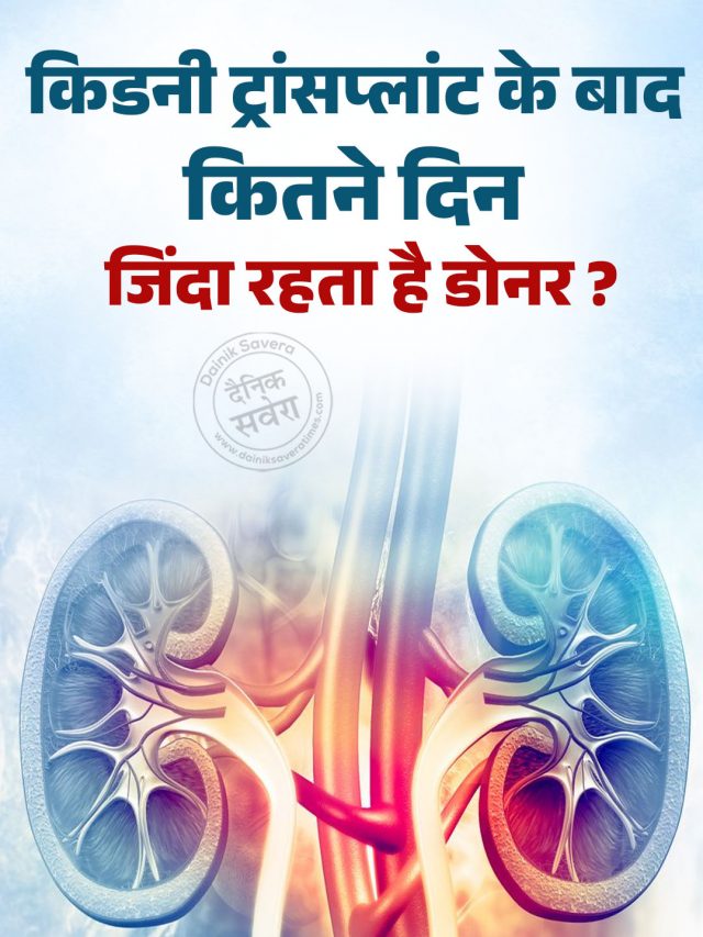 किडनी ट्रांसप्लांट के बाद कितने दिन जिंदा रहता है डोनर ?