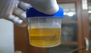 ओडिशा में शर्मनाक हरकत: चपरासी ने अफसर को पिलाया यूरिन, अस्पताल में करना पड़ा भर्ती