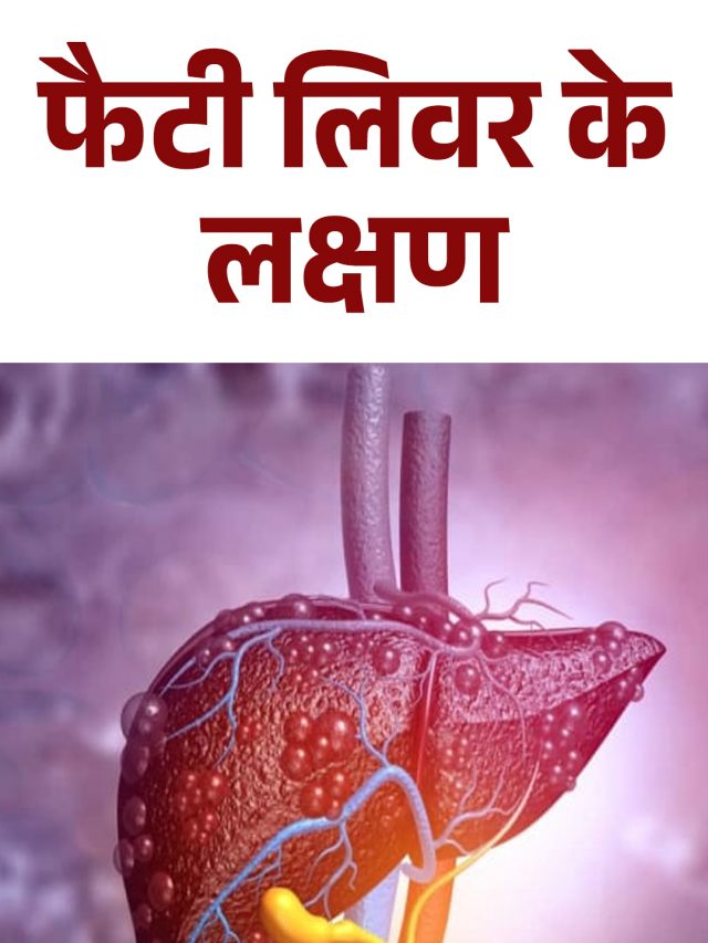 फैटी लिवर के लक्षण
