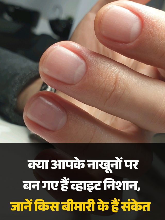 क्या आपके नाखूनों पर बन गए हैं व्हाइट निशान, जानें किस बीमारी के हैं संकेत