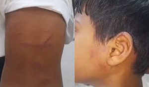 हरियाणा: 9 साल के बच्चे को रस्सी से बांध 4 घंटे पीटता रहा मौलवी, अस्पताल पहुंचा मासूम