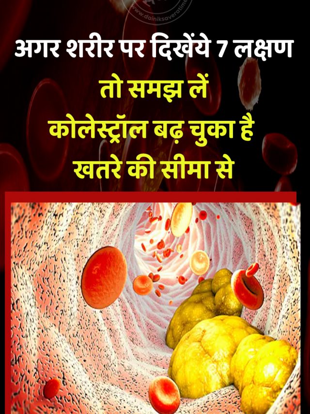 अगर शरीर पर दिखें ये 7 लक्षण, तो समझ लें कोलेस्ट्रॉल बढ़ चुका है खतरे की सीमा से