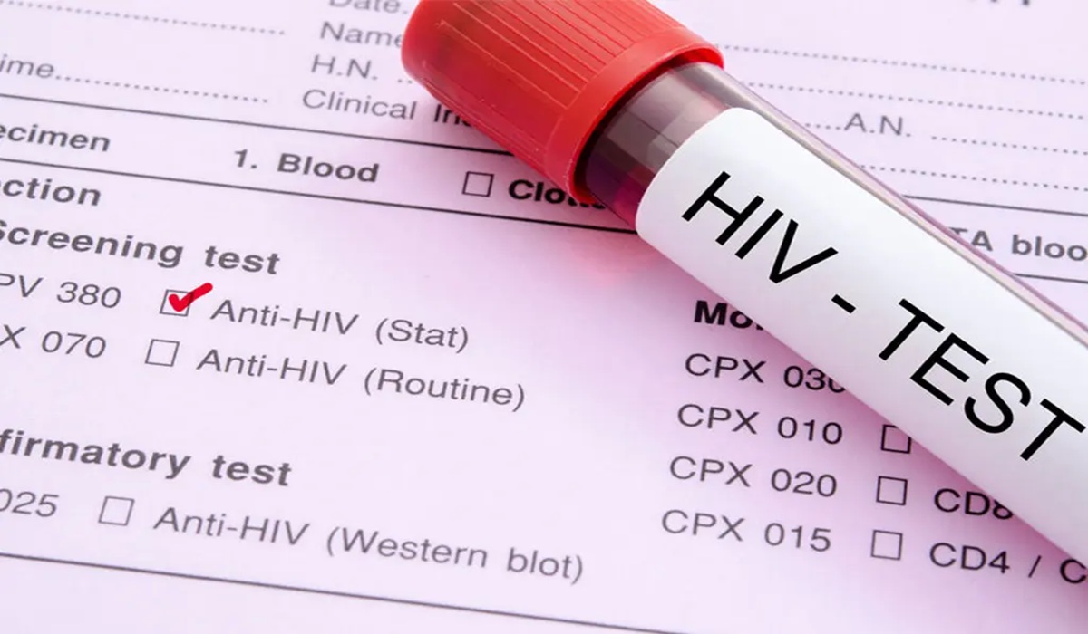 UNAIDS की बड़ी चेतावनी, 2030 तक सामने आ सकते हैं HIV के 3.3 मिलियन मामले 