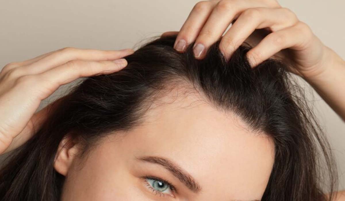 Hair Growth Tips: 30 दिनों में बालों का झड़ना करें कम! डाइट में शामिल करें ये फूड्स