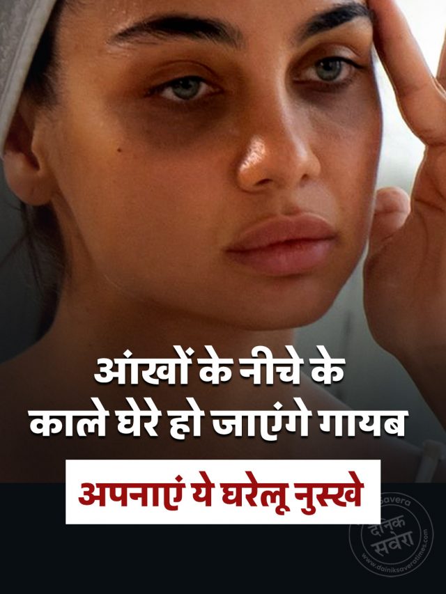 आंखों के नीचे के काले घेरे हो जाएंगे गायब, अपनाएं ये घरेलू नुस्खे