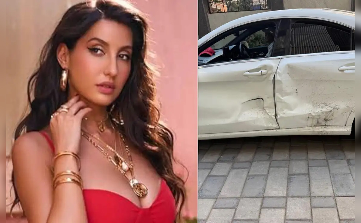 Nora Fatehi का हुआ कार एक्सीडेंट, एक्ट्रेस ने खुद शेयर किया Health Update