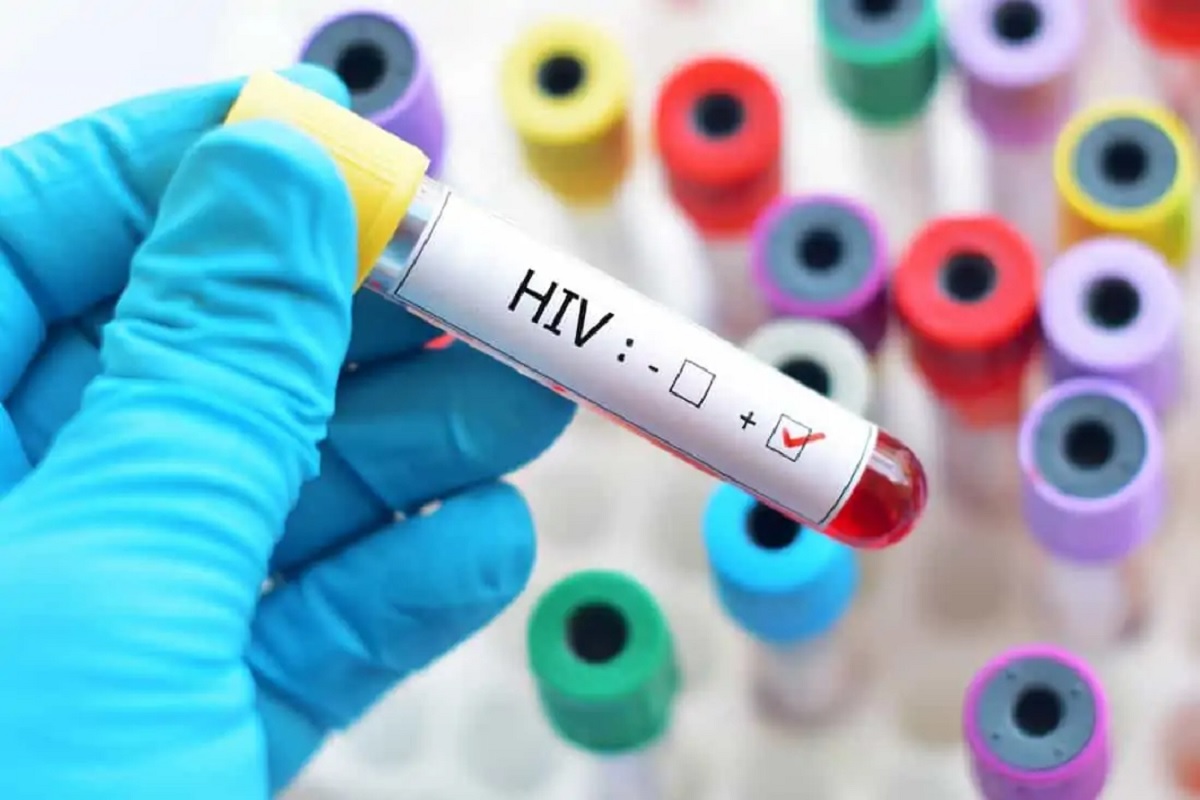 चंडीगढ़ में HIV मामलों में बढ़ोतरी, अभी तक 35 लोगों की जा चुकी है जान