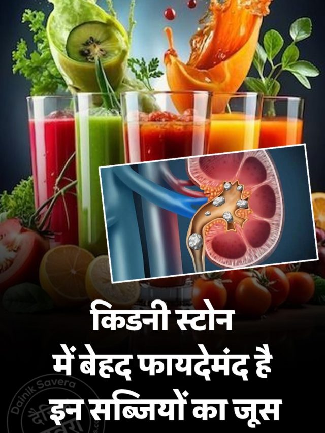 किडनी स्टोन में बेहद फायदेमंद है इन सब्जियों का जूस