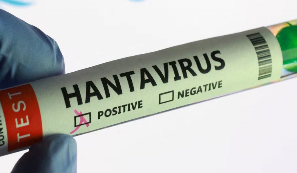 Hantavirus