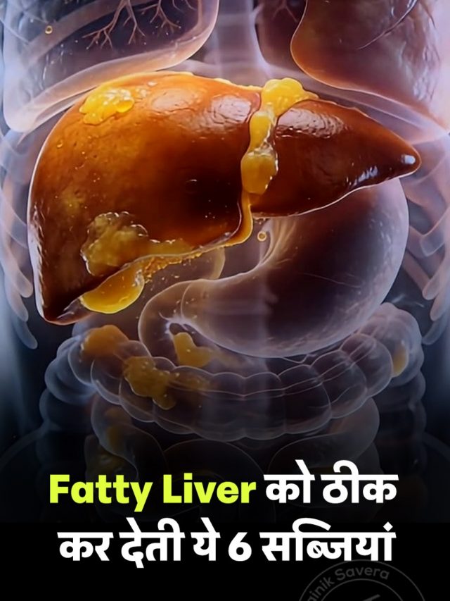 Fatty Liver को ठीक कर देती ये 6 सब्जियां