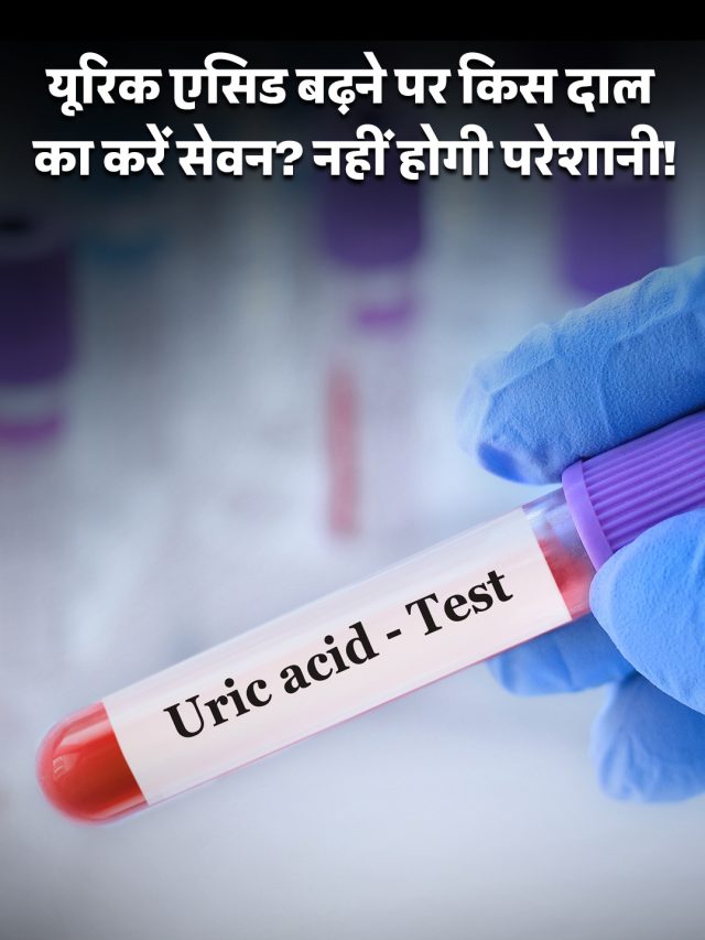 यूरिक एसिड बढ़ने पर किस दाल का करें सेवन? नहीं होगी परेशानी!