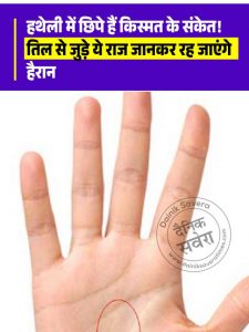 Palmistry Mole Reading