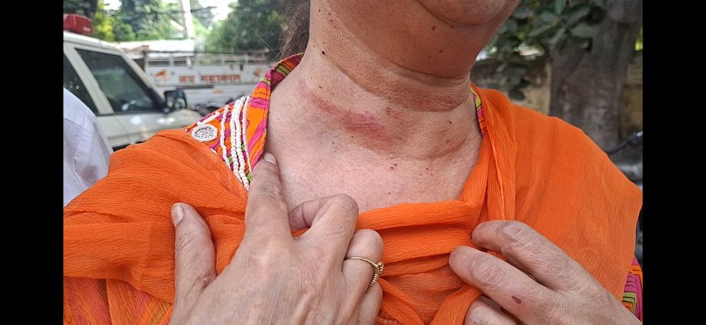 बाइक सवारों ने बंदूक की नोक पर बुजुर्ग महिला से छीनी सोने की चेन, CCTV कैमरे में कैद हुई घटना