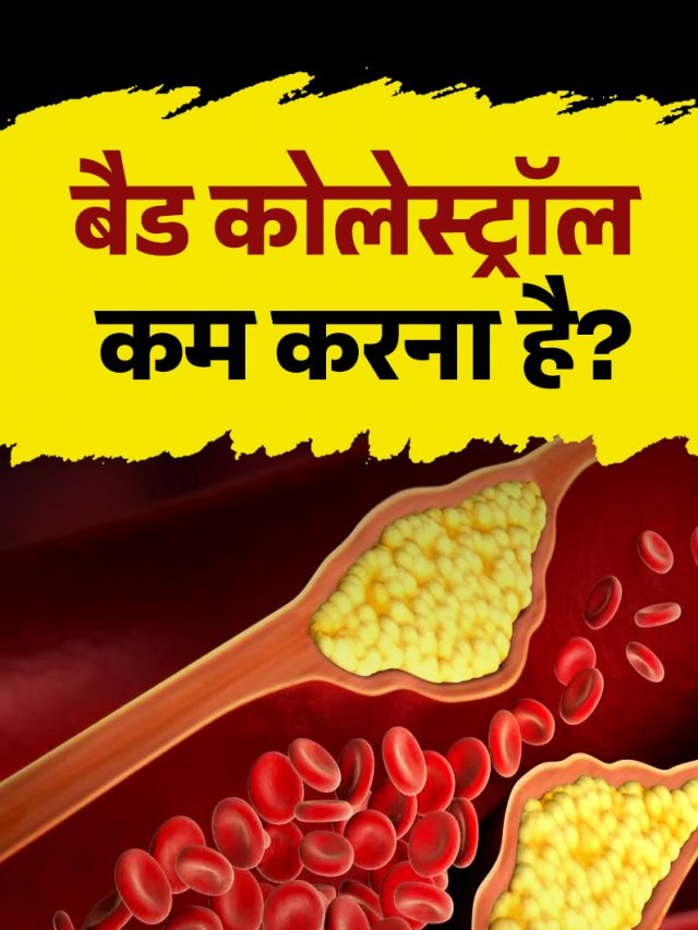 बैड कोलेस्ट्रॉल कम करना है? तो डाइट में शामिल करें ये 5 फल